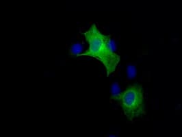BRAF / B-Raf Antibody (clone OTI1D4)