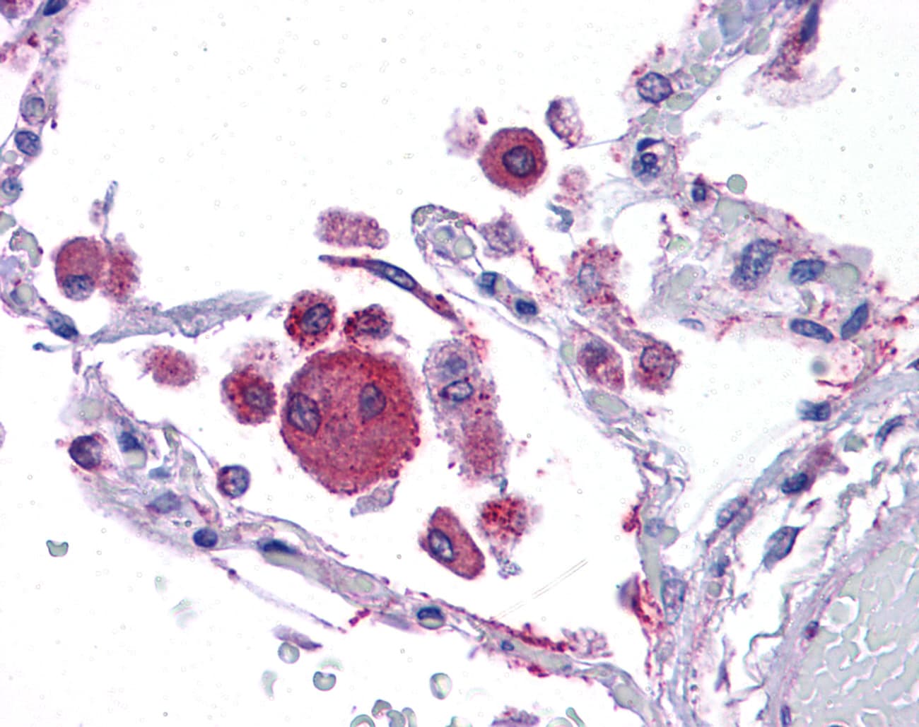 KITLG / SCF Antibody (aa180-229)