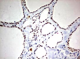 Monoclonal Mouse anti-Human TOP2A / Topoisomerase II Alpha Antibody (clone OTI2D12, aa1100-1531, IHC, WB)