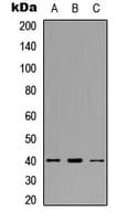 ACKR4 / CCRL1 / CCR11 Antibody (C-Terminus)