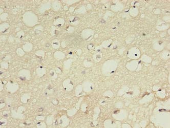 IFT27 / RABL4 Antibody (aa1-186)