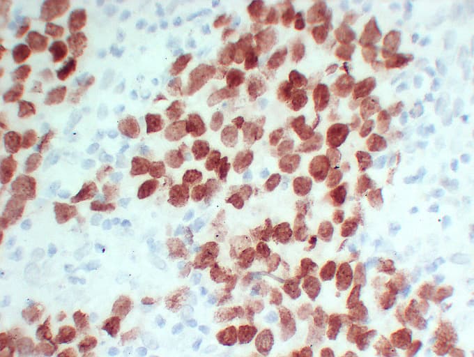 SALL4 Antibody (clone ABT-SALL4)