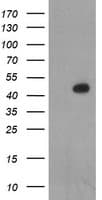 LHX1 Antibody (clone OTI1A5)