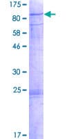Human CDKL3 Protein (Recombinant GST)