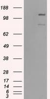 BUB1B / BubR1 Antibody (clone OTI10E7)