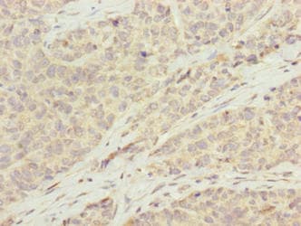 KCTD19 Antibody
