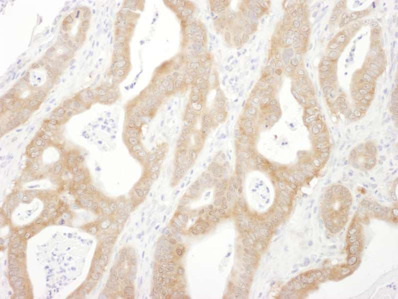 ARRB1 / Beta Arrestin 1 Antibody (aa368-418)