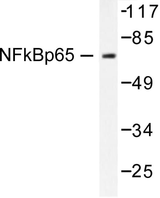 RELA / NFKB p65 Antibody (Leu523)