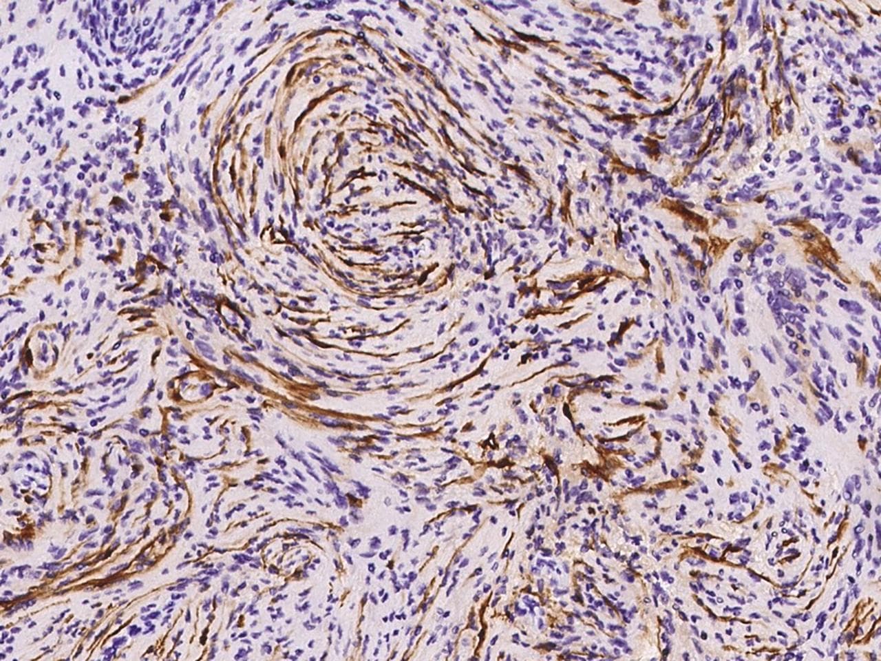 Monoclonal Mouse anti-Human S100B / S100 Beta Antibody (clone 03, Preservative Free, IHC)