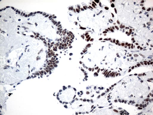 Monoclonal Mouse anti-Human GTF3C4 Antibody (clone OTI4A3, aa583-822, IHC, WB)