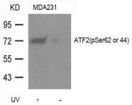 ATF2 Antibody