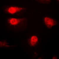 Polyclonal Rabbit anti-Human CDKN1B / p27 Kip1 Antibody (phospho-Thr187, IHC, IF, WB)