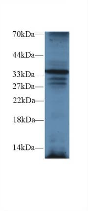 TRADD Antibody (aa21-259)