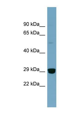HMG2 / HMGB2 Antibody (aa107-156)