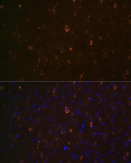 ABCA2 Antibody