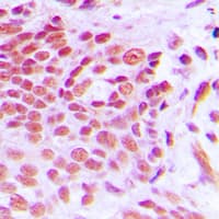 NAB2 Antibody (Internal)