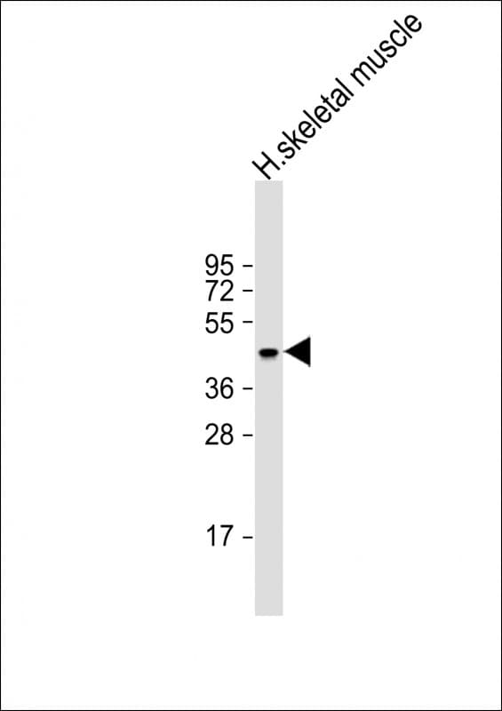 ERVK-21-Env Antibody (Internal)