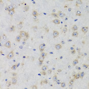 Polyclonal Rabbit anti-Human ISG15 Antibody (IHC, WB)