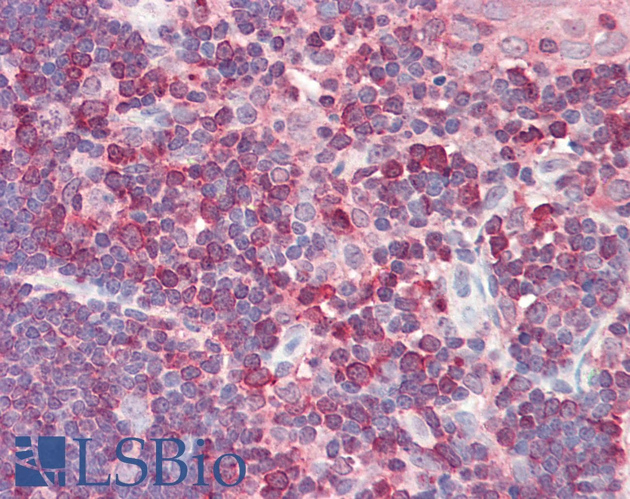 IHC-plus™ Polyclonal Rabbit anti-Human CDK5RAP3 Antibody (aa341-390, IHC, WB)