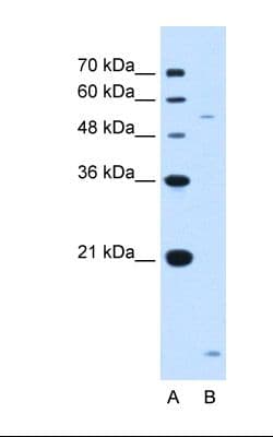 ST3GAL5 / GM3 Synthase Antibody (aa151-200)