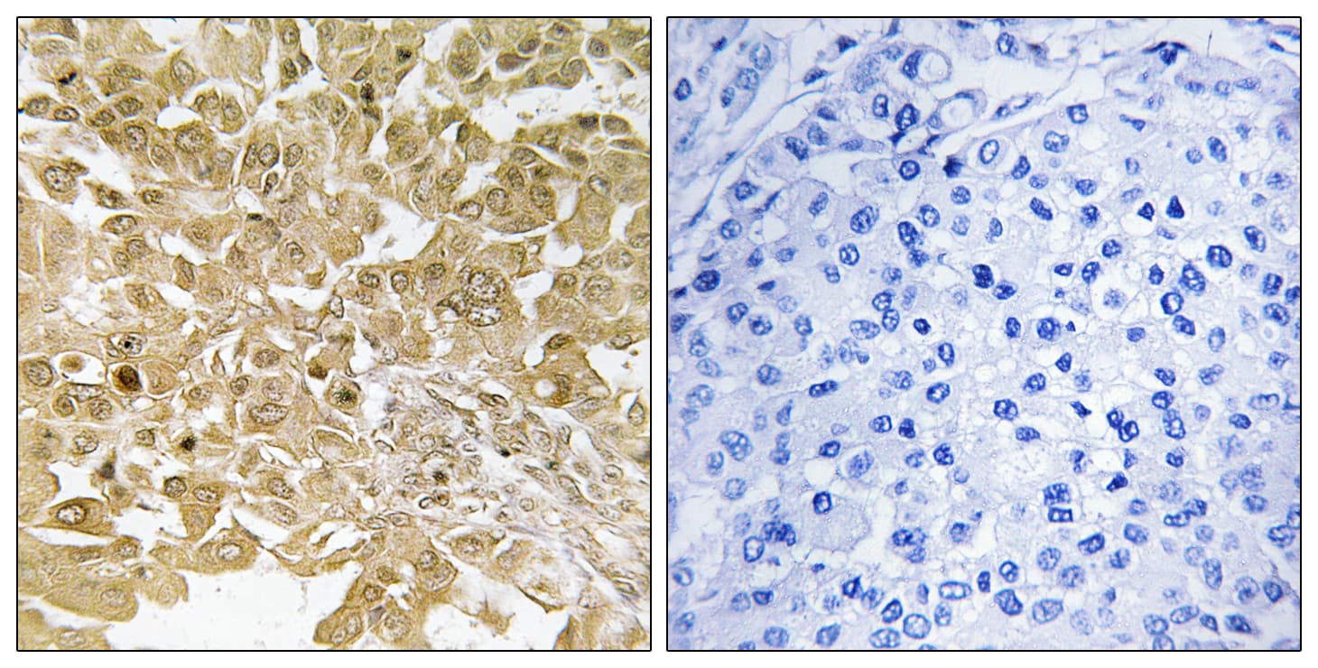 MAP2K1 / MKK1 / MEK1 Antibody (aa261-310)