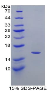 Mouse CXCL9 / MIG Protein (Recombinant His-T7)