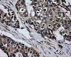 GBE1 Antibody (clone OTI4E6)