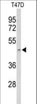 Acrosin Antibody (aa99-127)
