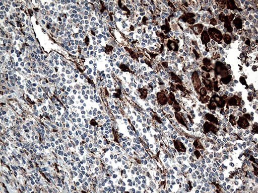 CTSL / Cathepsin L Antibody (aa114-333, clone OTI5C8)