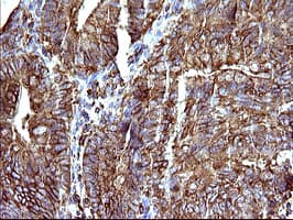 SCAMP2 Antibody (clone OTI3C2)
