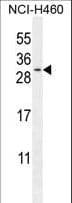 TEX37 / TSC21 Antibody (aa73-101)