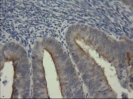 SERPINB3 Antibody (clone OTI3C2)