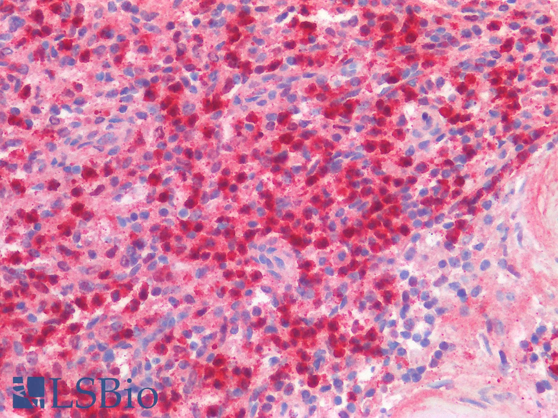 MMP12 Antibody (aa270-362)
