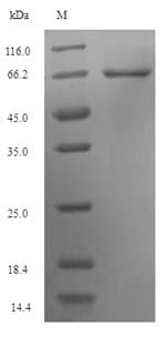Human KRT35 / Keratin 35 / KRTHA5 Protein (Recombinant 6His-SUMO, N-terminus)