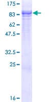 Human TTBK2 Protein (Recombinant GST)