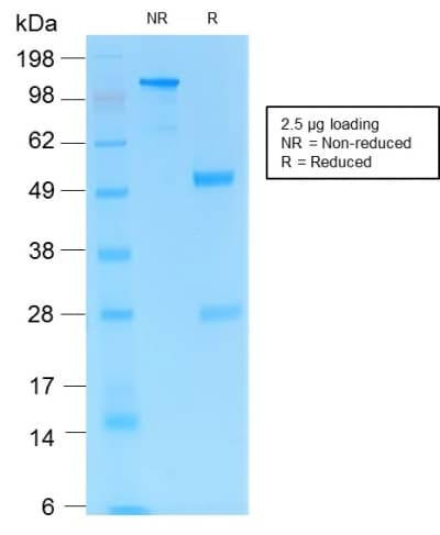 PathPlus™ Recombinant Monoclonal Rabbit anti-Human PECAM-1 / CD31 Antibody (clone C31/1395R, IHC, WB)