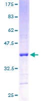 Human RPL5 / Ribosomal Protein L5 (Recombinant GST)