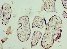 Polyclonal Rabbit anti-Human NVL Antibody (aa340-520, IHC, WB)