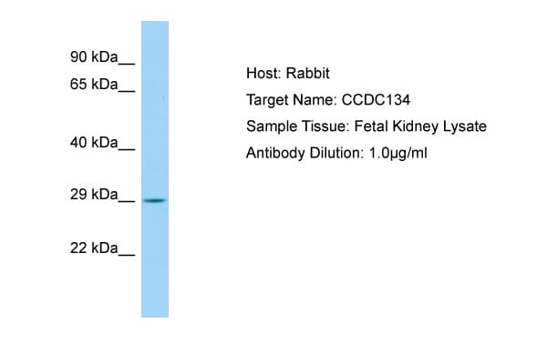 Polyclonal Rabbit anti-Human CCDC134 Antibody (aa143-192, WB)
