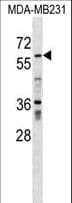 Polyclonal Rabbit anti-Human ZNF543 Antibody (aa40-67, WB)