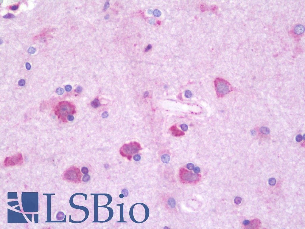 IHC-plus™ Polyclonal Rabbit anti-Human RAB6C Antibody (aa165-214, IHC, WB)