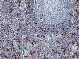 F13A1 / Factor XIIIa Antibody (clone OTI3F1)
