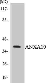 Polyclonal Rabbit anti-Human ANXA10 / Annexin A10 Antibody (aa248-297, WB)