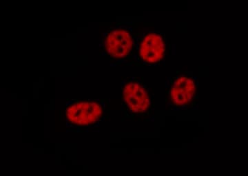 ZNHIT1 Antibody