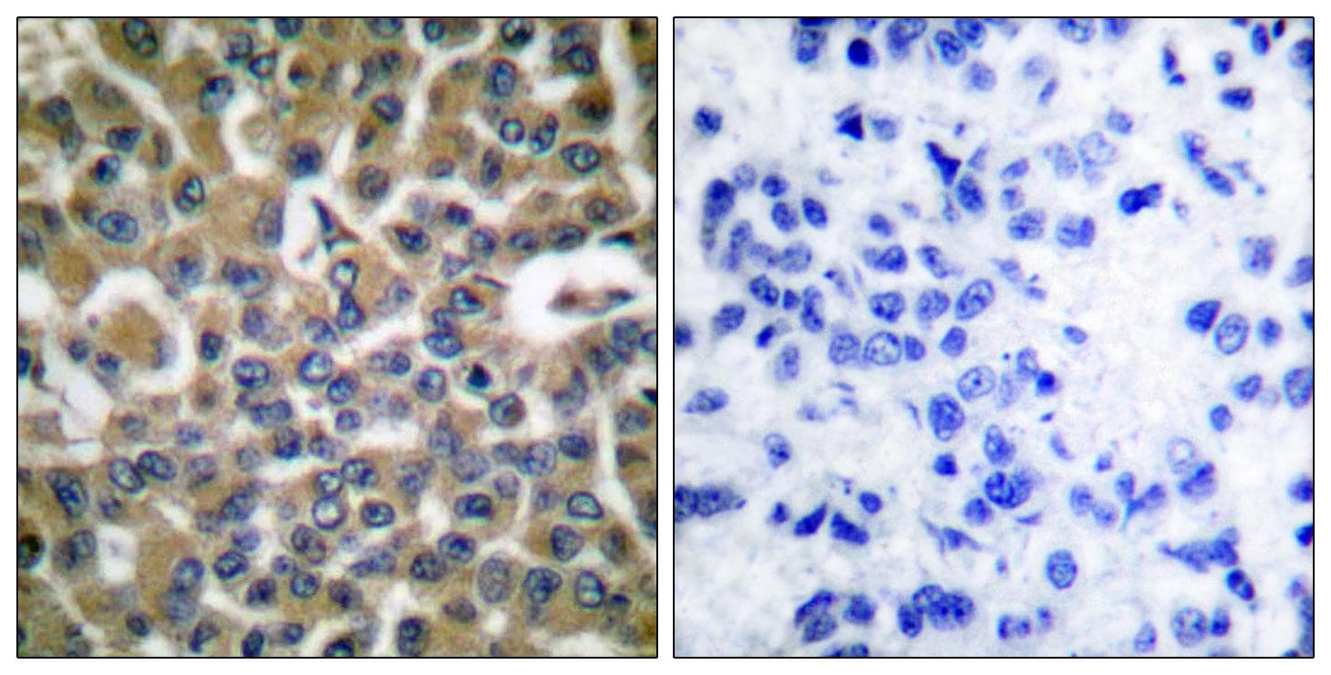 EEF2 / Elongation Factor 2 Antibody (p56)
