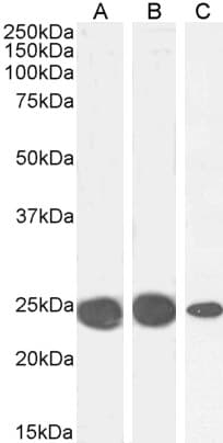 IHC-plus™ CBX5 / HP1 Alpha Antibody (aa88-102)