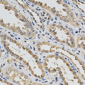 EIF4E Antibody