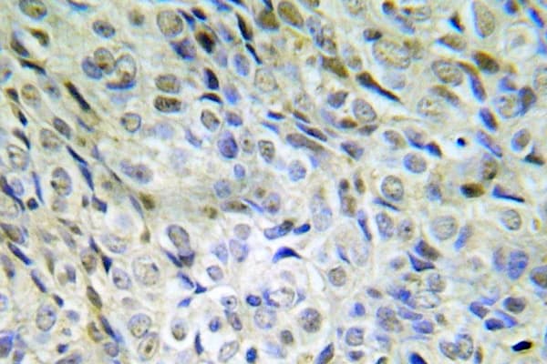 CTNNB1 / Beta Catenin Antibody (phospho-Ser33)