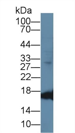 MB / Myoglobin Antibody (aa1-154, APC)