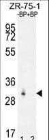 RAB40AL Antibody (aa7-36)